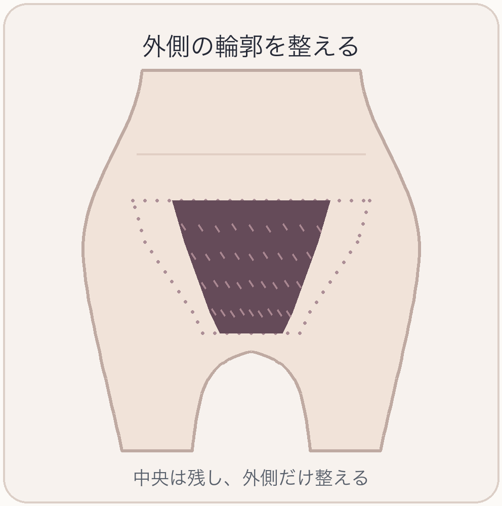 Vライン中央を残し、左右の外側だけを狭くする模式図。点線が元の範囲